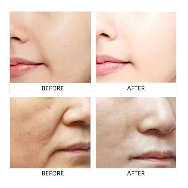 anti-aging facial lifting collagen