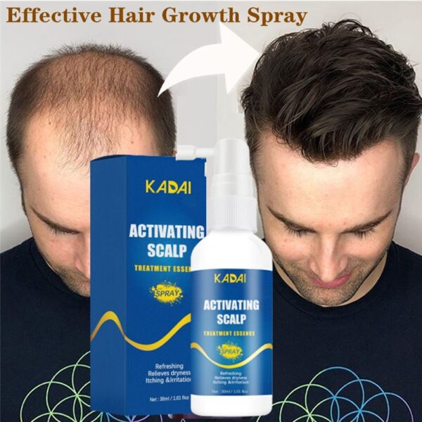Hair-Growth-Serum-Spray
