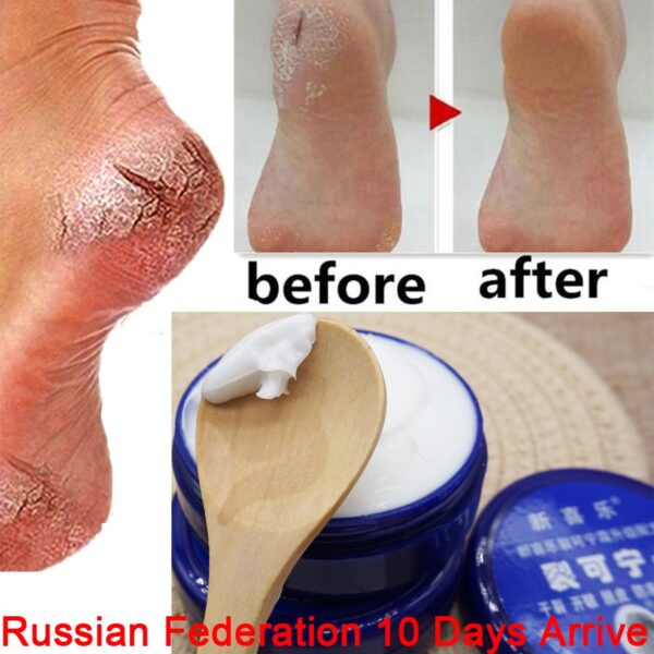 ant-drying crack foot cream