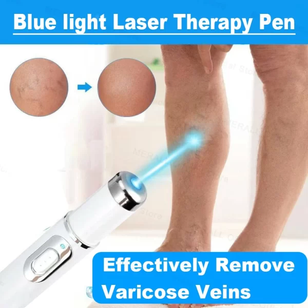 Varicose Veins Relieve Blue Light Laser Therapy Pen