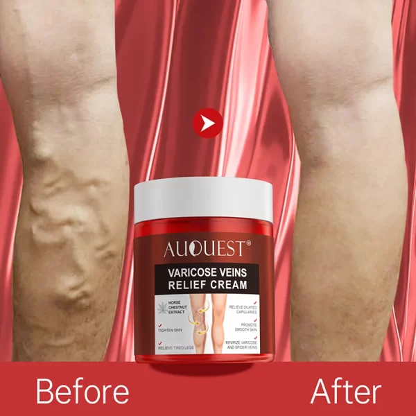 Varicose Vein Repair Cream 50g