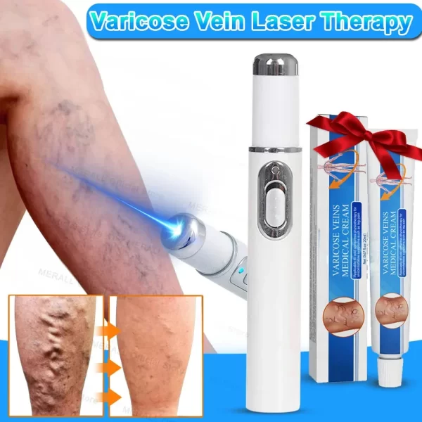 Varicose Veins Relieve Blue Light Laser Therapy Pen