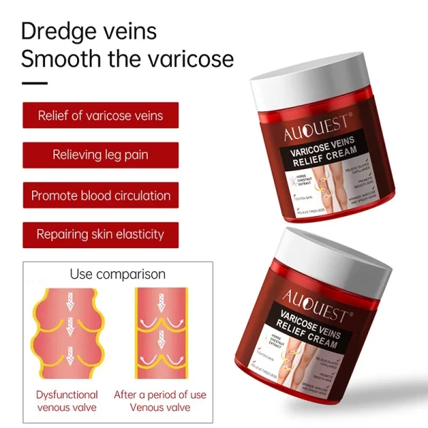 Varicose Vein Pain Relief Cream