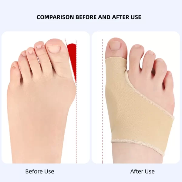 1Pair Toe Separators for Foot Care