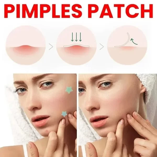 Acne/Pimple Patch Facial Skin Care